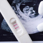 Court Ruling Sparks Abortion Access CHAOS Pregnancy test next to an ultrasound image and two white pills