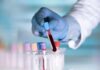 That “Normal” Blood Test May Not Stay Normal Gloved hand holding a blood sample tube